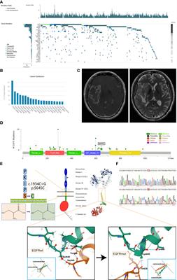 S645C Point Mutation Suppresses Degradation of EGFR to Promote Progression of Glioblastoma